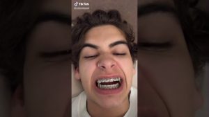 Orthodontics tiktok orthodontists dentists marketing sydney agency